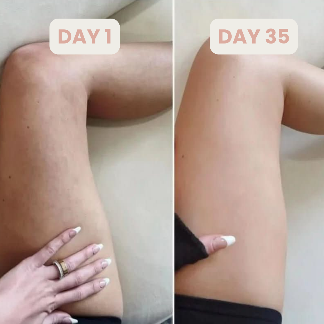 LuxLift™ Cellulite Smoothing Massager
